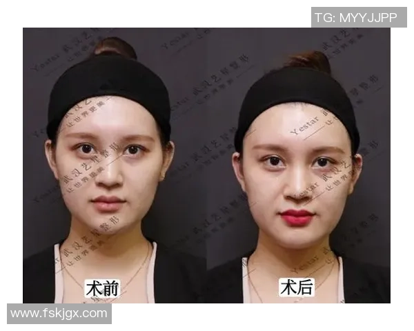 足球球星玻尿酸:从运动场到美容界的跨界之路揭秘 足球球星玻尿酸:从运动场到美容界的跨界之路揭秘